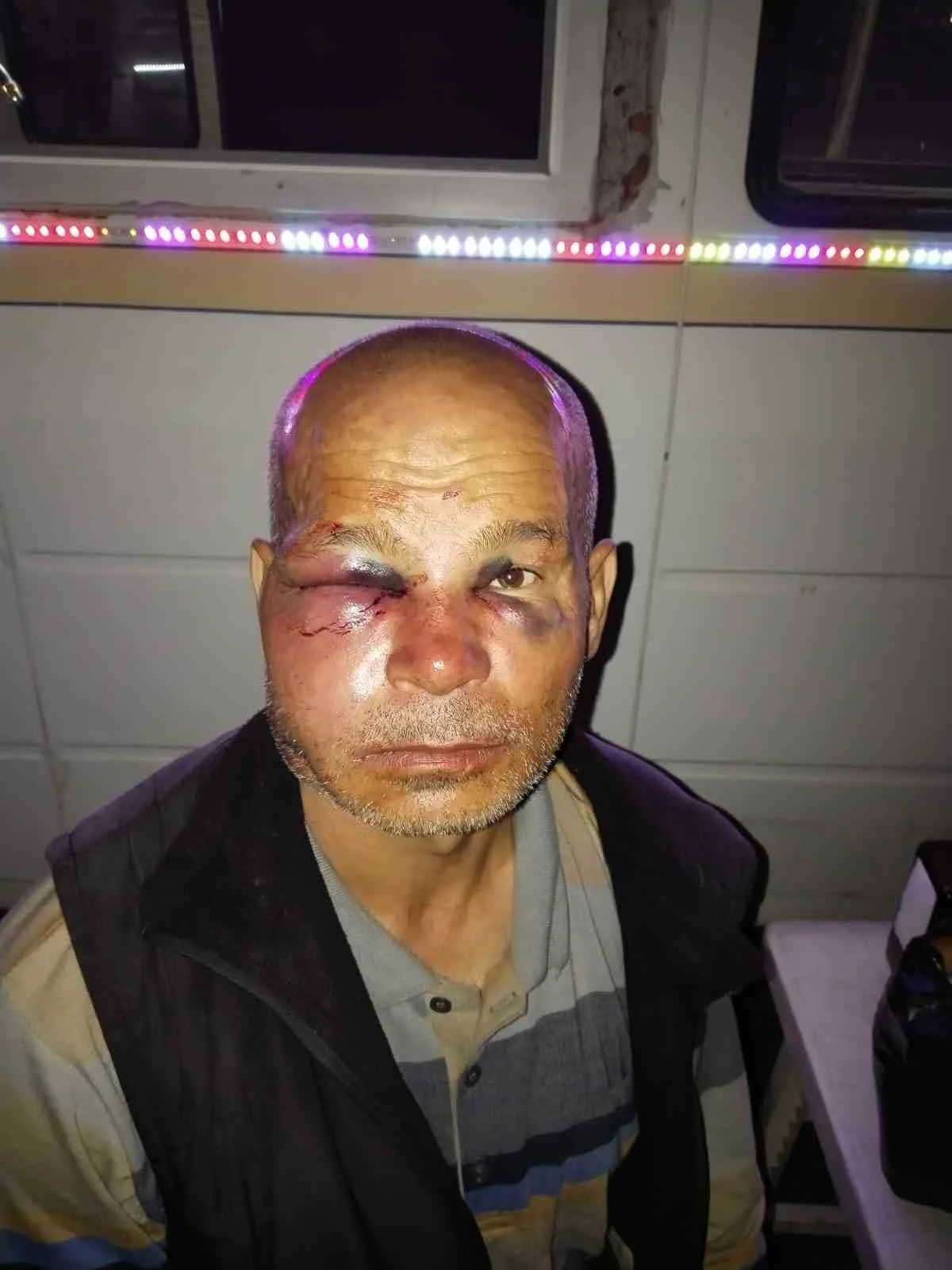Duyma ve konuşma engelli adamı darp ettiler, aile şikayetçi oldu